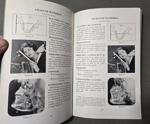 Röntgenstrahlen in der Zahnmedizin Kodak Firma Sanitätsabteilung 1932 ERSTAUSGABE Buch - Bild 8 von 10