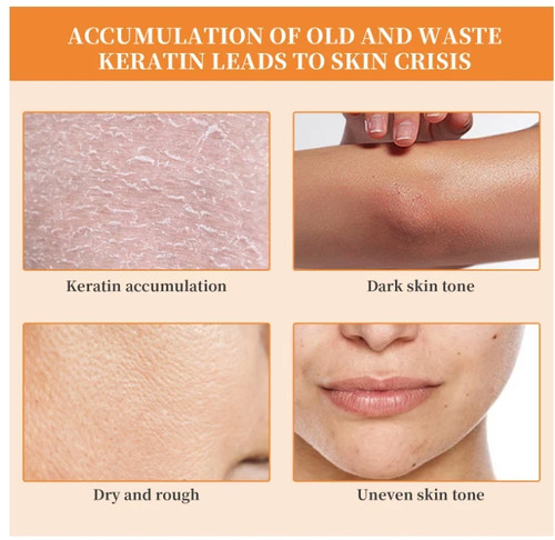 Gel exfoliante naranja natural 2 piezas exfoliante para rostro y cuerpo exfoliante colágeno - Imagen 2 de 5