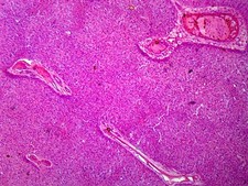 Liver, Mammalian; Showing Hepatic Cells; Section; H&E Stain
