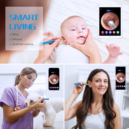 Vasgic Ear Wax Tool Removal con fotocamera Ear Scope Otoscopio con kit luce - Foto 6 di 9