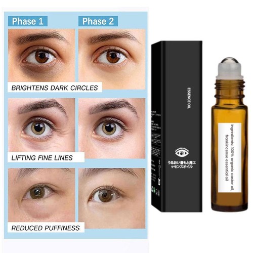 8ml Rollerball Castor Oil & Frankincense Castor Oil and Frankincense Eye Roller. - Picture 5 of 16
