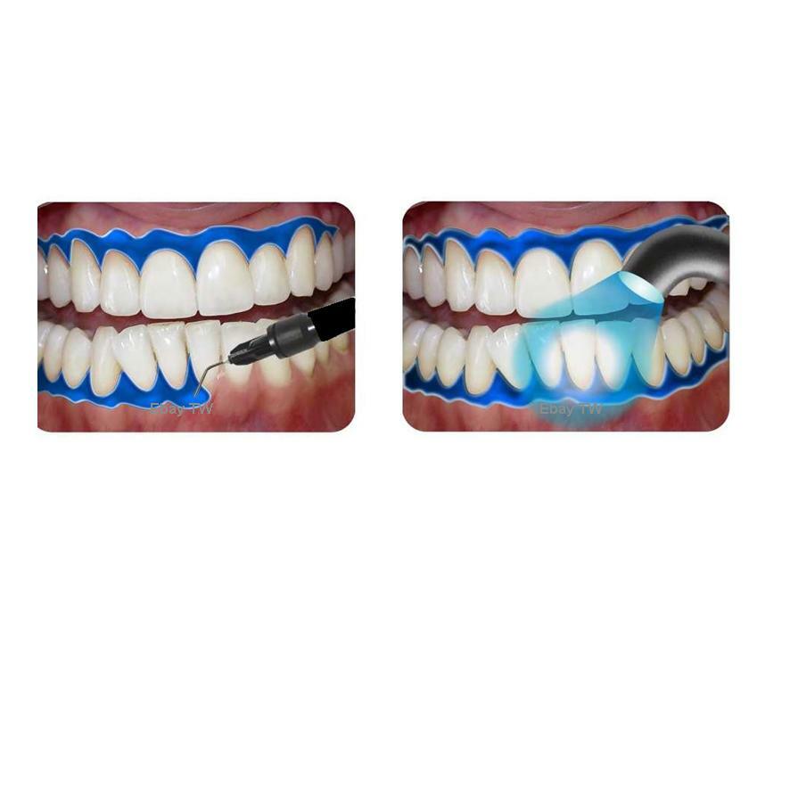 GUM DAM DAMS GINGIVAL BARRIER x 5 LARGE 3ML & 10 TIPS PROTECTION TEETH