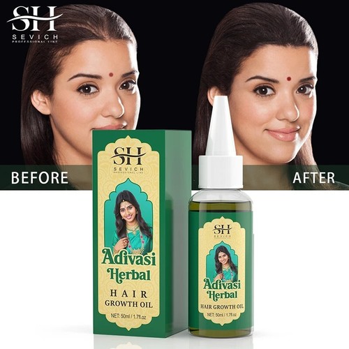 Ayurvedic Hair Growth Oil India Adivasi Organic Serum Anti Hair Loss Fast Growth - Picture 5 of 16