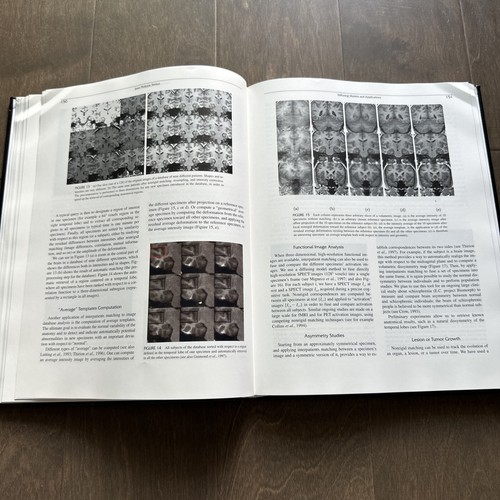 Brain Warping A. Toga 1st Edition Hardcover 9780126925357 Brain Mapping - 第 12/17 張圖片