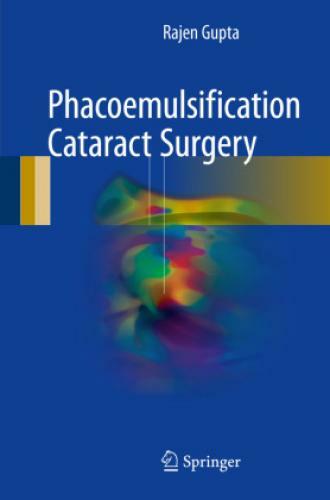 Thumbnail - Phacoemulsification Cataract Surgery 3873
