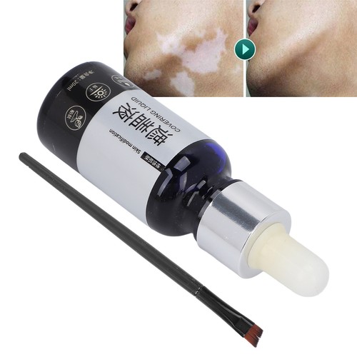 Vitiligo Covering Liquid Waterproof Makeup Vitiligo Concealer Cosmetics For TOU - Picture 6 of 22