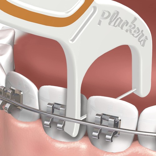 Orthopick Floss Picks, Unflavored, Designed for Braces, Fold-Out FlipPick, Tu... - Picture 5 of 6