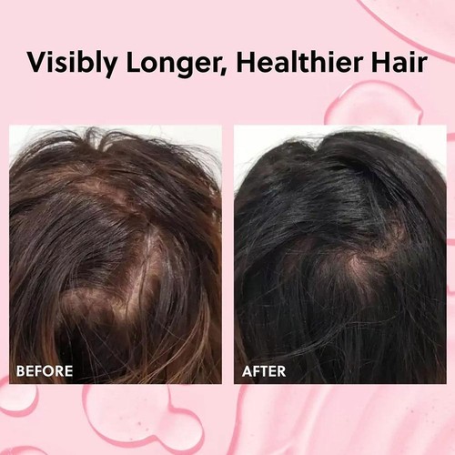 Advanced Hair Growth Oil Spray -Non-Greasy Hormone Free Formula -Promotes Thic k - Picture 3 of 10