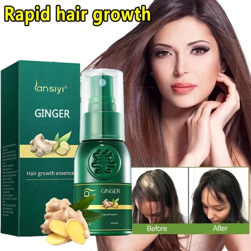 Natural Hair Growth Essence Thickener Fast Regrowth Serum Hair Loss Treatment - Picture 8 of 28