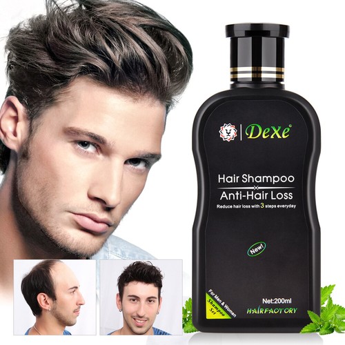 200ml Dexe Anti Hair Loss Shampoo Natural Herbal Hair Growth Treatment Women Men - Picture 11 of 18