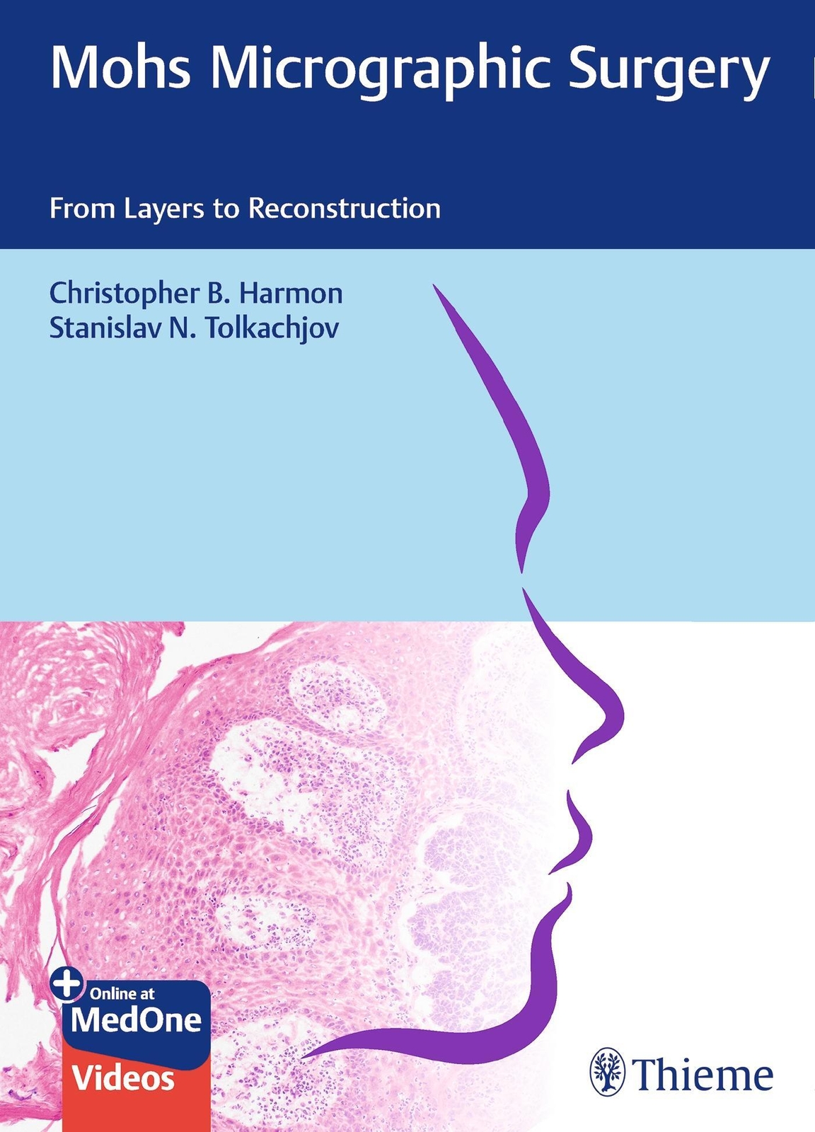 Thumbnail - Mohs Micrographic Surgery: From Layers To Reconstruction | From Layers