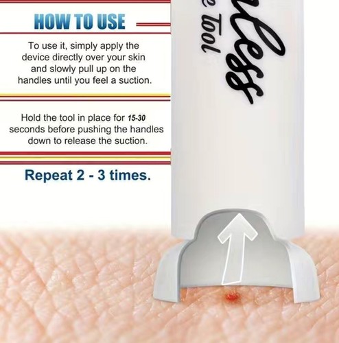 Mosquito Anti-itch Extraction Needle Device, Mosquito Insect Outdoor Portable In - Bild 2 von 7