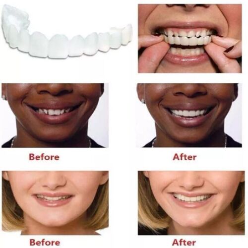 Juego de dientes postizos superior e inferior a presión carillas dentales dentaduras postizas cubierta dental falsa - Imagen 10 de 15