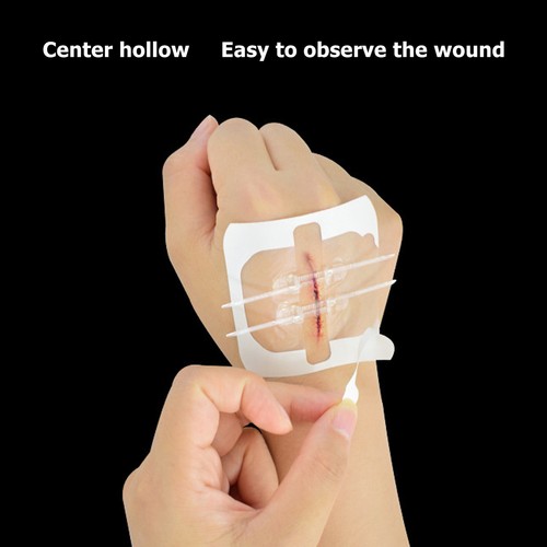 2pcs Emergency Wound Closure Device Zip Laceration Repair Adhesive Bandage W GFL - Picture 18 of 23