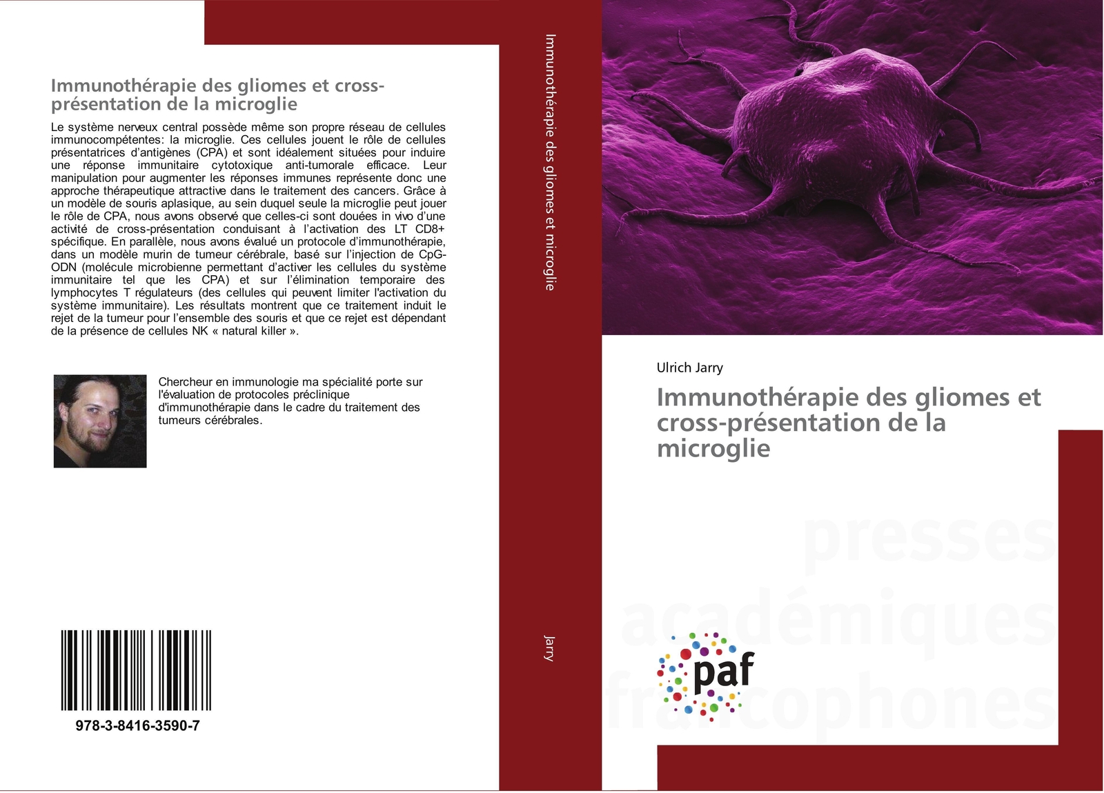 Thumbnail - Ulrich Jarry | Immunothérapie Des Gliomes Et Cross-présentation De La