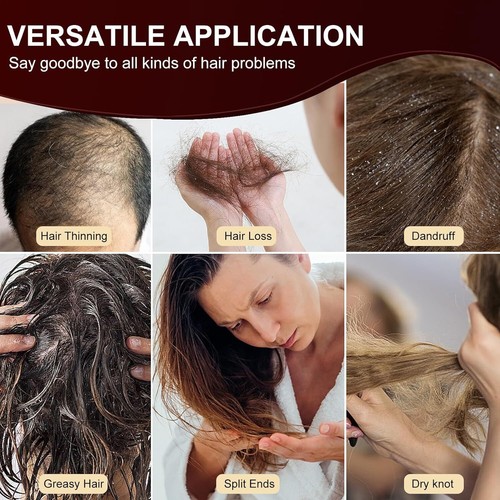 Elektrischer Haarkamm Vibration Kopf Massagegerät Rot LED Entspannung Kopfhaut Relax Massage - Bild 9 von 11