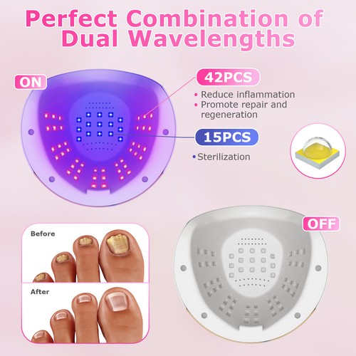 Nail Fungus Treatment For Toe and Finger Nail Fungal Infections Natural Cure US - Picture 6 of 15