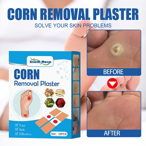 Foot Corn Removal Medical Plaster Foot Pad Patch Dead Skin Callus Remover Relief - Picture 5 of 10