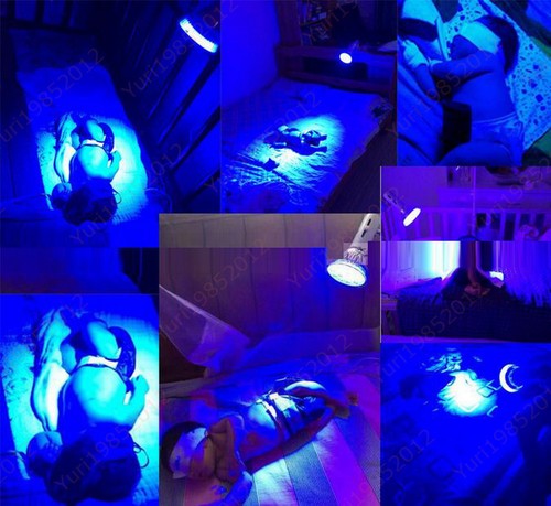 485nM 15 Watts Baby Care Neonatal Jaundice Phototherapy LED Blue Ray Light Lamp - Picture 6 of 12