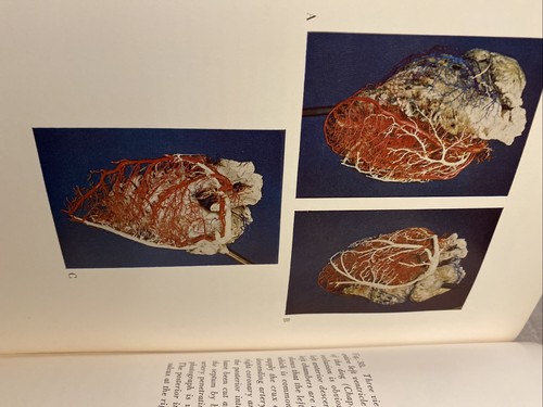 Anatomy of the Coronary Arteries Thomas N James First Edition 1961 Hardcover - Picture 11 of 13