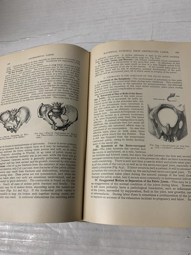 ANTIQUE MEDICAL BOOK-THE PRACTICE OF OBSTETRICS 1908 HB 1279 ILLUSTRATIONS - Picture 16 of 17