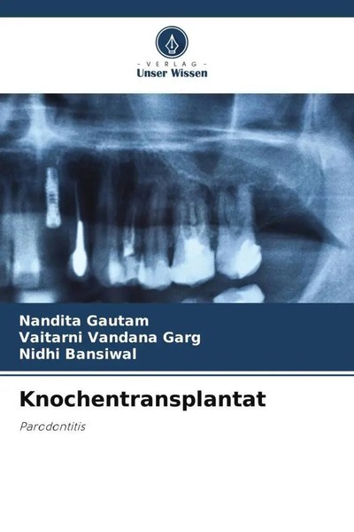 Nandita Gautam (U. A.) | Knochentransplantat | Taschenbuch | Deutsch (2022)-image