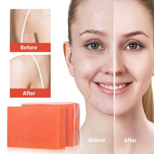 2X Original Kojic Acid Skin Whitening Dark Spot Removing 5 Bars Soap - Picture 8 of 18