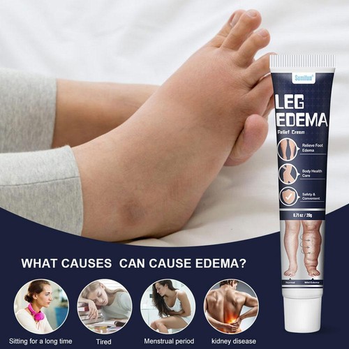 New 20g Anti Edema Cream Remove Arm Leg Swelling Pain Relief Ointment Best K4Y8 - Picture 4 of 12