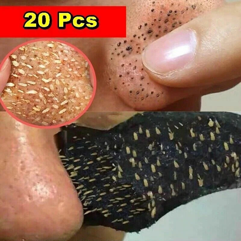 20 piezas Tiras de limpieza de poros de nariz removedor de espinillas máscara despegable pegatina Foto 2 de 4