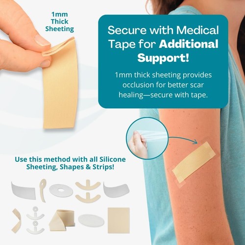 Reusable 1" x 6" Silicone Scar Sheets for Surgery, Burns & Keloid Care - 4 Pack - Picture 4 of 10