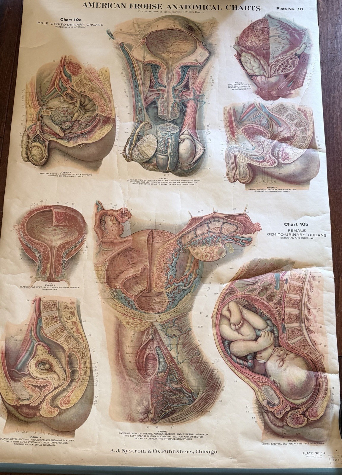 1922 A.J. Nystrom Male & Female Genito-Urinary Chart Pregnancy Labor Plate 10
