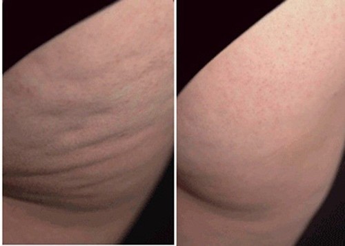 ALL NEW MADE IN THE USA 100% Natural BUTT BOOTY CREAM FREE SHIPPING - Picture 7 of 8