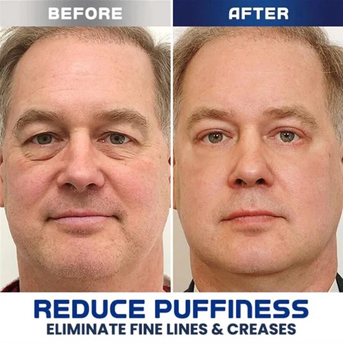 VEZE 15G Gel de ojos para hombre con hialuronato de sodio para ojeras e hinchazón - Imagen 6 de 11