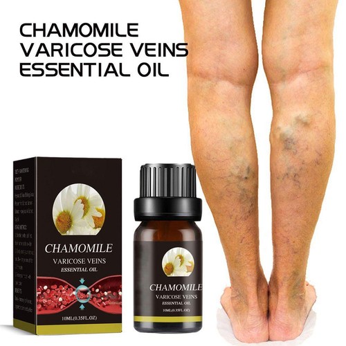Marronie Chamomile Essential Oil For Varicose Veins Treatment Legs -2023- M9W2