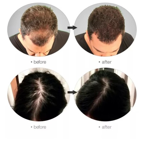 FEG Organic Anti Hair Loss Hair Growth Treatment Oil - 50ML - Picture 3 of 5