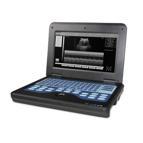 DE Stock,Ultraschall-Scanner Bauch konvexe Sonde Ultraschall-Diagnose Maschine - Bild 9 von 12