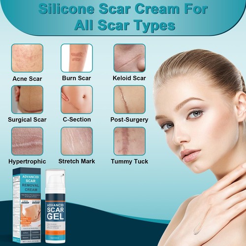 Narbencreme, Advanced Narbengel für alte & neue Narben, professionelle Narbenentfernungscreme - Bild 2 von 6