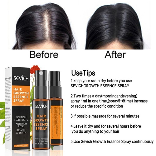 Fast Regrowth Prevent Hair Damaged Thinning Repair Ginger Hair Growth Spray - Picture 5 of 6