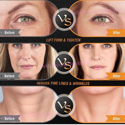 2in1 Facial Body Radio Frequency Machine RF Skin Tightening Face Lifting Beauty - Foto 12 di 14