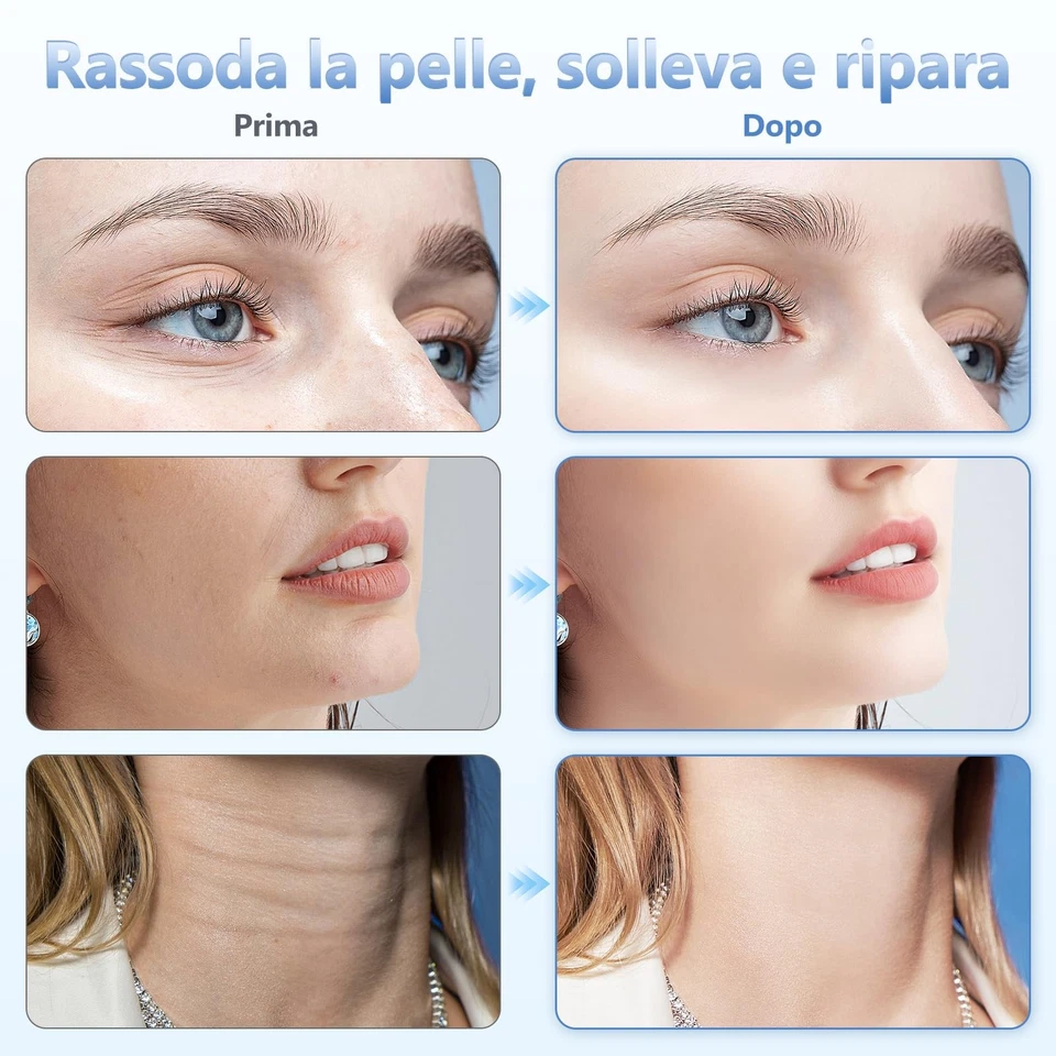 Massaggiatore Elettrico EMS per Viso 6 Modalità Rassodamento Lifting Antirughe - Immagine 3 di 4