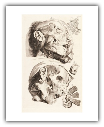 Govard Bidloo : "Flayed Human Head (Table 12)" (1685) — Giclee Fine Art Print - Picture 5 of 7