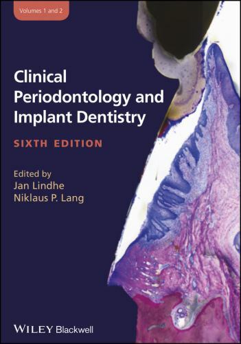 健康・医学 Textbook of Clinical Periodontology Essentials of Clinical Periodontology & Periodontics