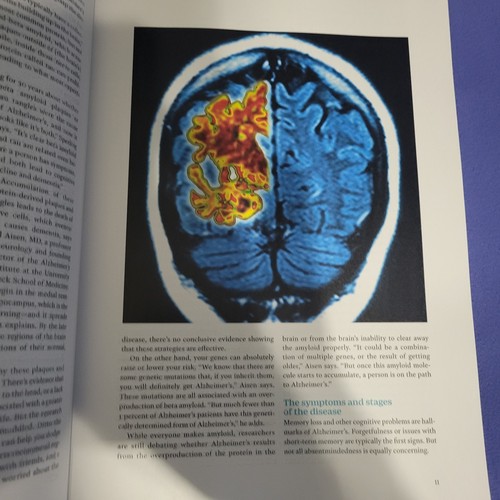 The Science of Alzheimer's: Time Magazine 2025 ~ What It Is ~ Latest Science - Picture 5 of 8