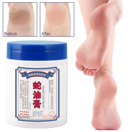 Olio di Serpente Crema Idratante e Anticrackingα - Foto 2 di 13