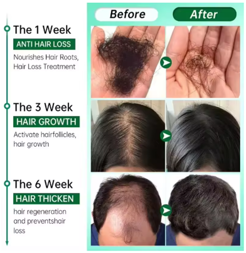 Lidoria Hair Growth Serum 7 Days Fast Regrowth Anti-Hair Loss Scalp Repair - Picture 3 of 8