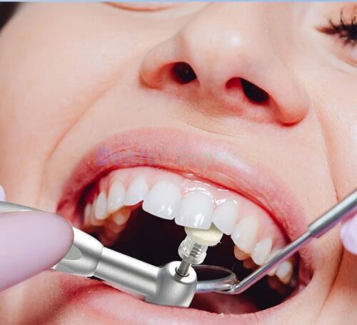 50 discos de pulido compuestos dentales pasta pulidora fieltro impregnado rueda mandril - Imagen 3 de 7