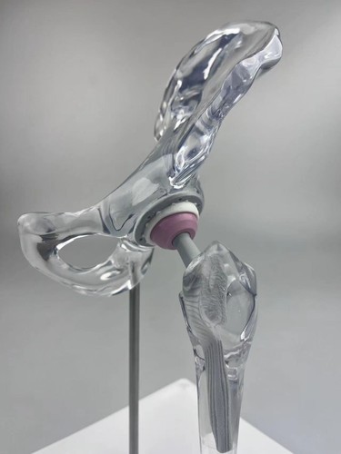 Artificial Shoulder replacement Anatomical model Knee Shoulder Elbow joint model - Picture 18 of 47
