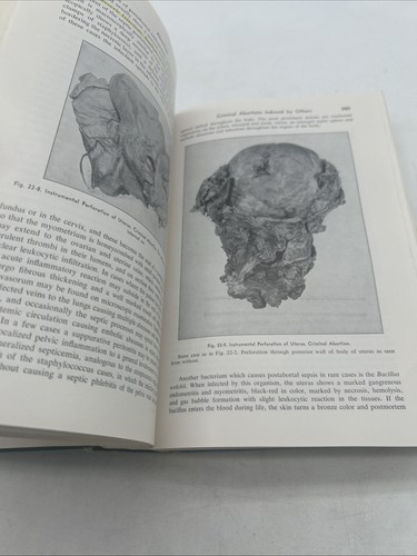 Legal Medicine Pathology Toxicology Gonzales 1954 2nd Ed Vance Helpers Umberger - Picture 9 of 17