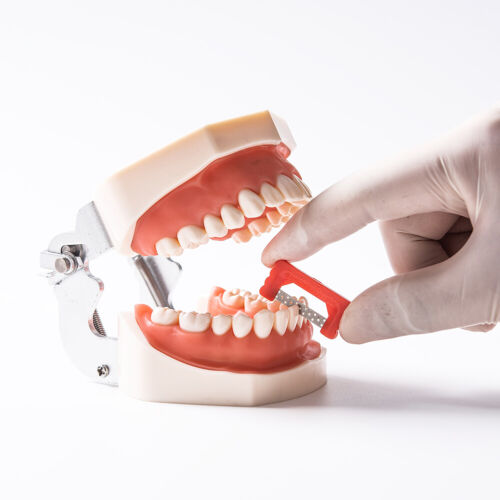 10 Stck. Dental IPR/IR Streifen Kieferorthopädische interproximale Reduktion Emaille Streifen Wiederverwendung - Bild 2 von 9