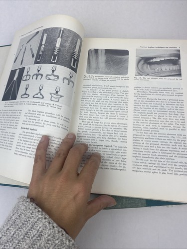 1970 2 Vol Set Theories and Techniques of Oral Implantology Linkow Chercheve HC - 第 14/24 張圖片